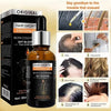 Hair Growth Essential Oil – Biotin Cold-Pressed DHT Blocker – 30ml (Anti Hair Loss)
